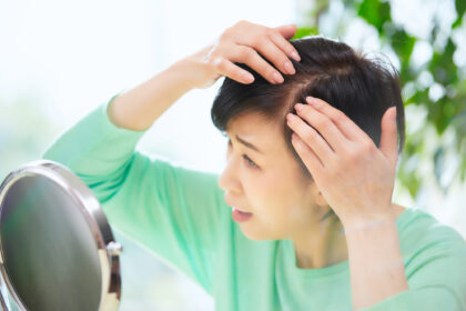 女性型脱毛症とは