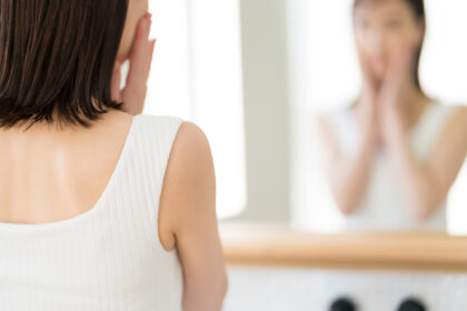 すっぴん時の顔の赤みは皮膚科へご相談ください